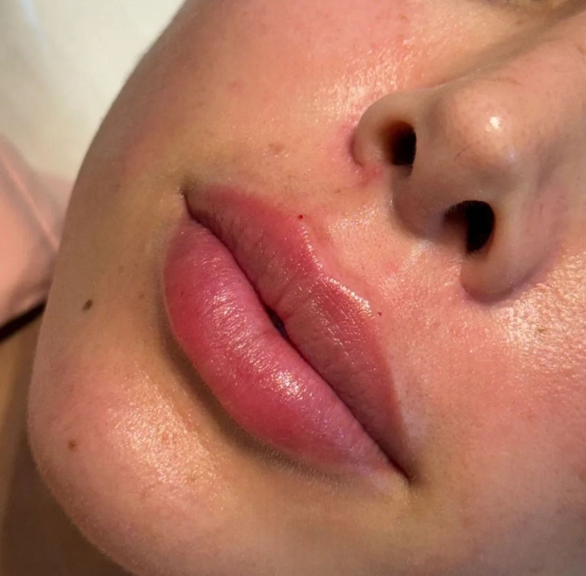 Natural / Classic (Doğal Görünüm)